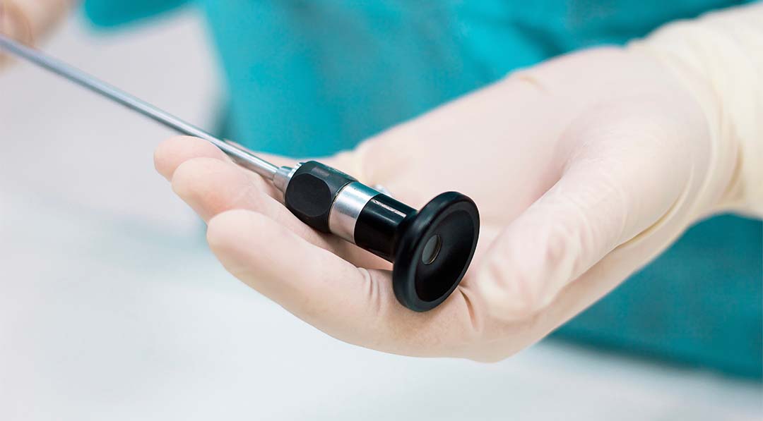 Histeroscopia-exame-ginecologico